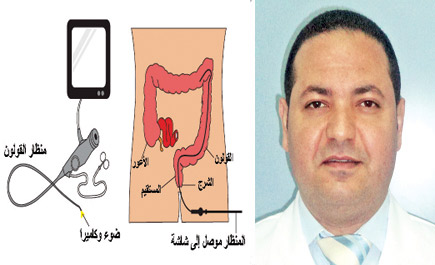 منظار القولون السيني المرن.. واجب لمن تجاوز الخمسين 