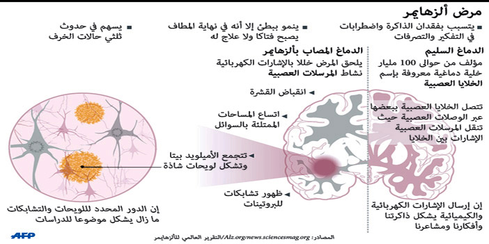 الزهايمر معدٍ في العمليات الجراحية 