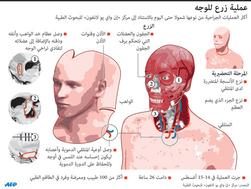 أول جراحة من نوعها في العالم لزرع وجه بالكامل لرجل إطفاء أمريكي 