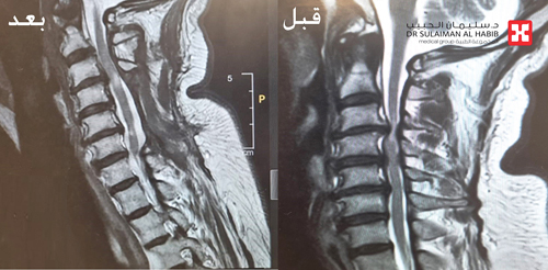 استمرت معاناته لسنوات 