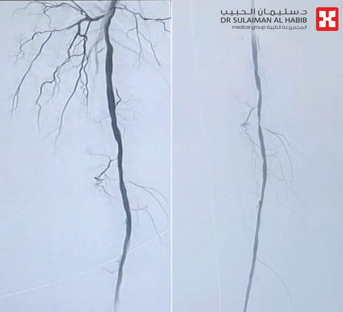 باستخدام أحدث تقنية 